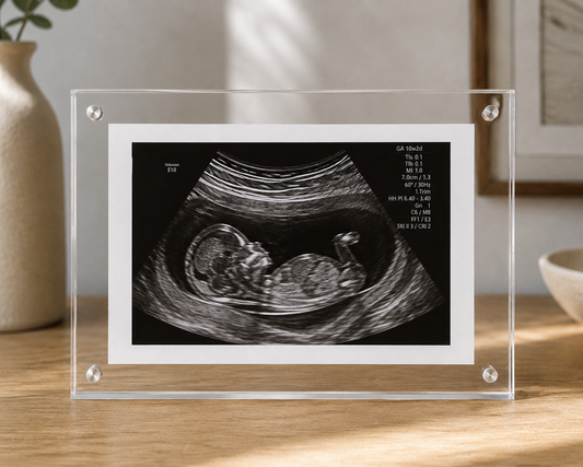 5×7 Magnetic Floating Keepsake Frame